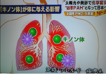 PM2.5 身体に与える影響.png